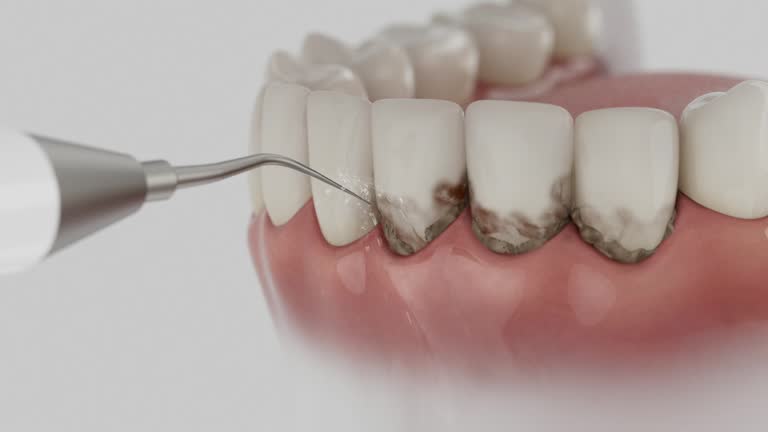 Trusted Teeth Cleaning And Checkup service in Colfax, LA - Dentist Open Now